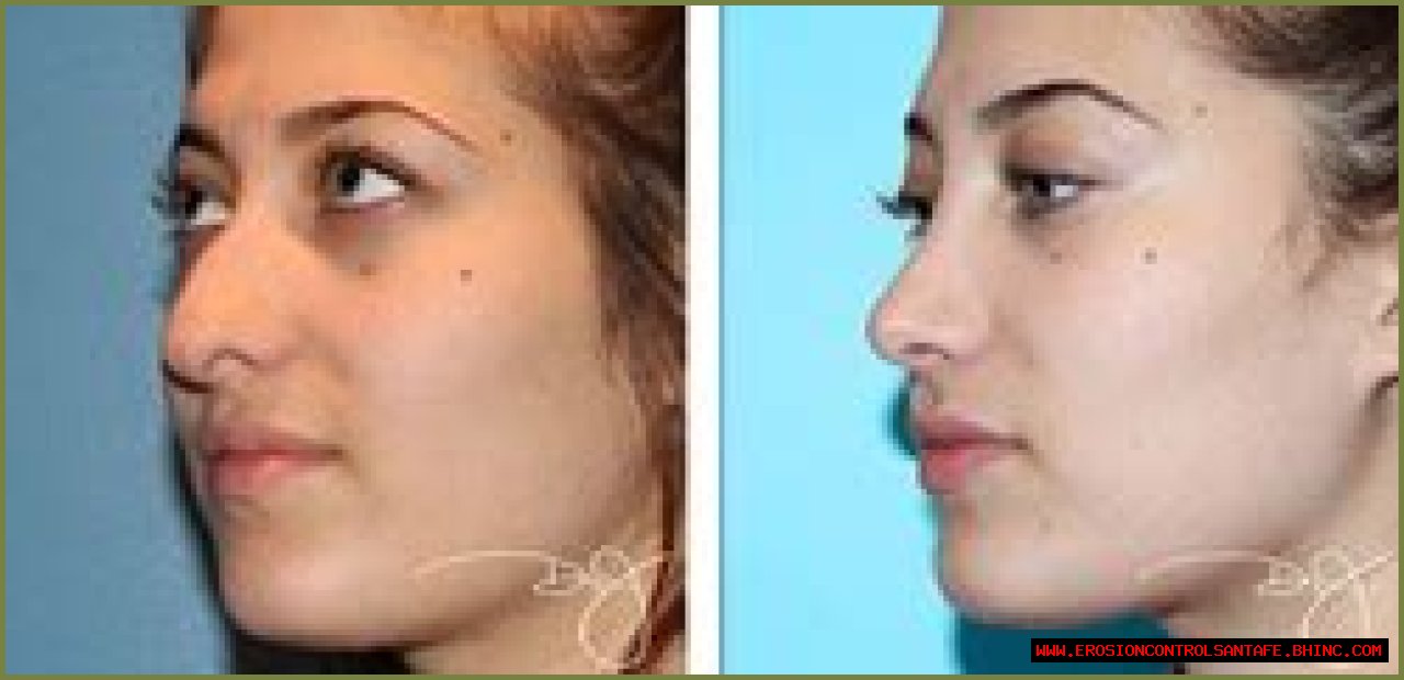 Celebrity Plastic Surgery Patients with Happy Stories to Tell Illustrate the Overwhelmingly Positive Outcomes of Most Procedures, Says Dr. J Plastic Surgery