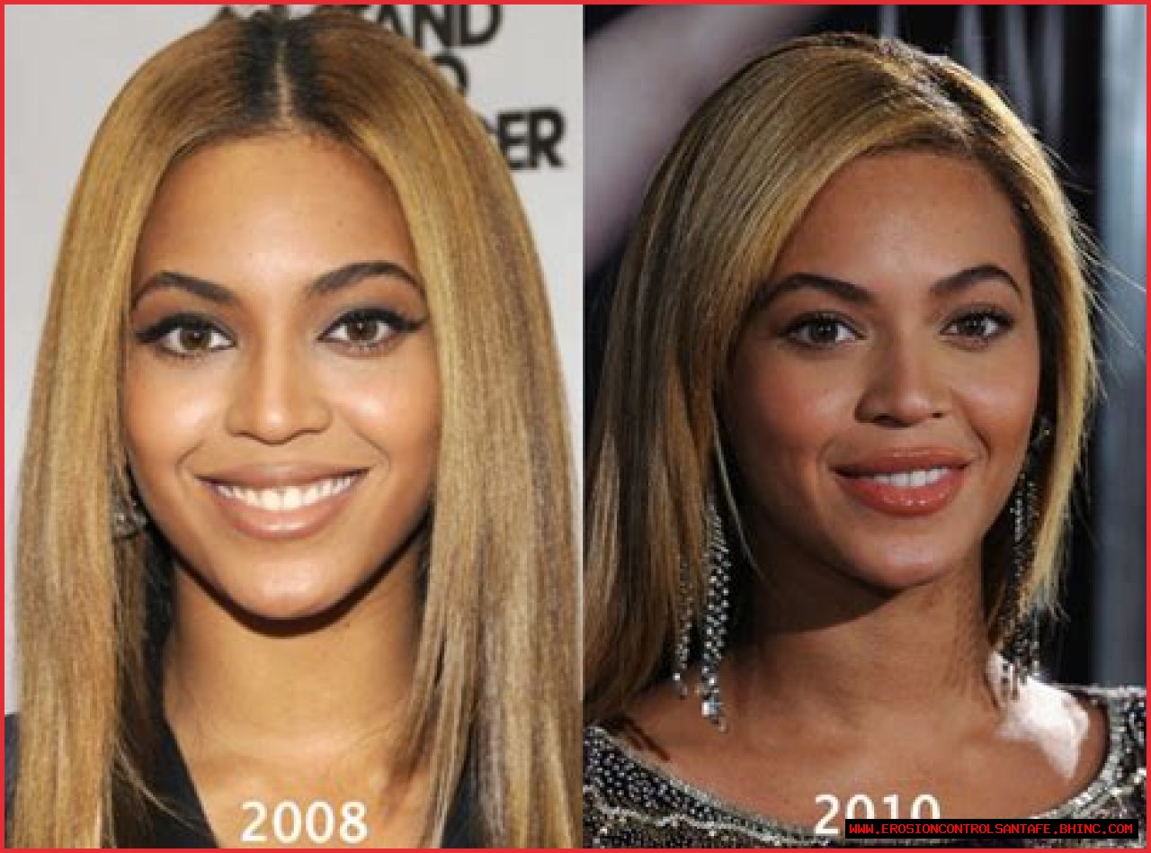 Has Beyonce had Plastic Surgery? Why Did Beyonce Get Foot Surgery?