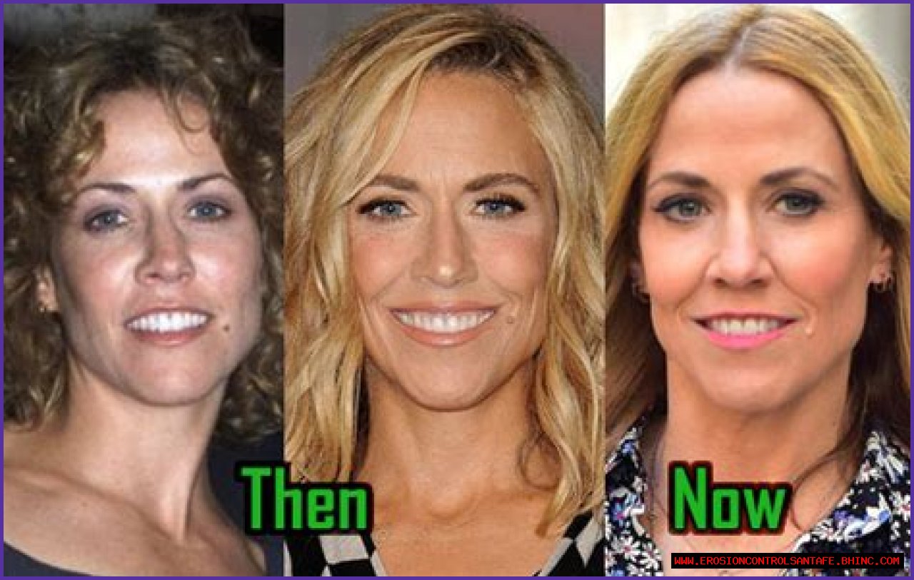 Has Sheryl Crow Had Plastic Surgery? Who is Sheryl Crow?